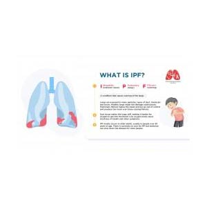 New Infographics to explain Idiopathic Pulmonary Fibrosis (IPF) - Irish ...