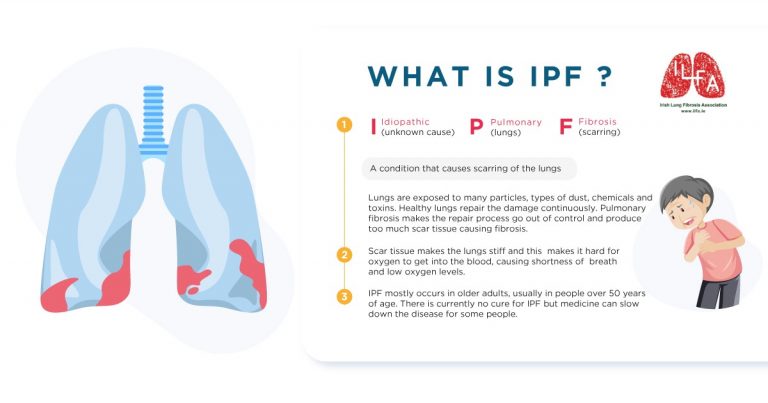 Infographics - Irish Lung Fibrosis Association